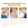 Ximonth Vein Renewal Smooth Legs Cream, Relief Sore Legs Massage Varicose Earthworm Leg Vein Care Cream