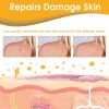 Ximonth Beesvenom Wart Care Spray, s Flesh Particle Mole Smooth Skin Wart Spray