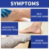 Ximonth Vein Comfort Spray, Relief Leg Muscle Soreness And Swelling Earthworm Leg Vein Spray
