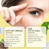 Hoygi Eye Cream Eye Essence s Fine Lines Under Eye Bags, Moisturizes And s Eye Condition, Nourishes Tenderness And Brightening